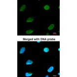 Immunofluorescence - CBFA2T2 antibody from Signalway Antibody (22165) - Antibodies.com