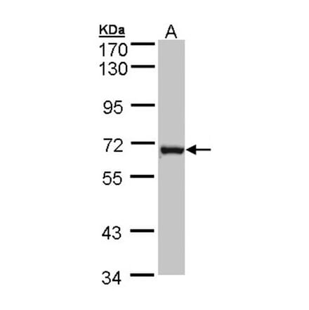 DENND1B antibody from Signalway Antibody (22531) - Antibodies.com