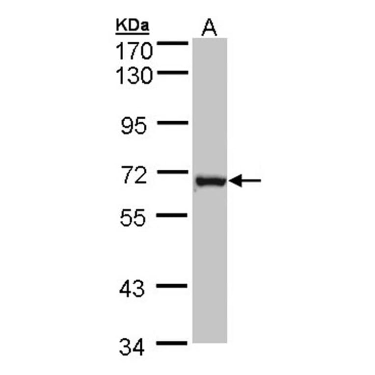 DENND1B antibody from Signalway Antibody (22531) - Antibodies.com