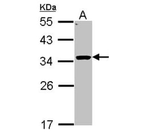 HSD11B1 antibody from Signalway Antibody (22621) - Antibodies.com