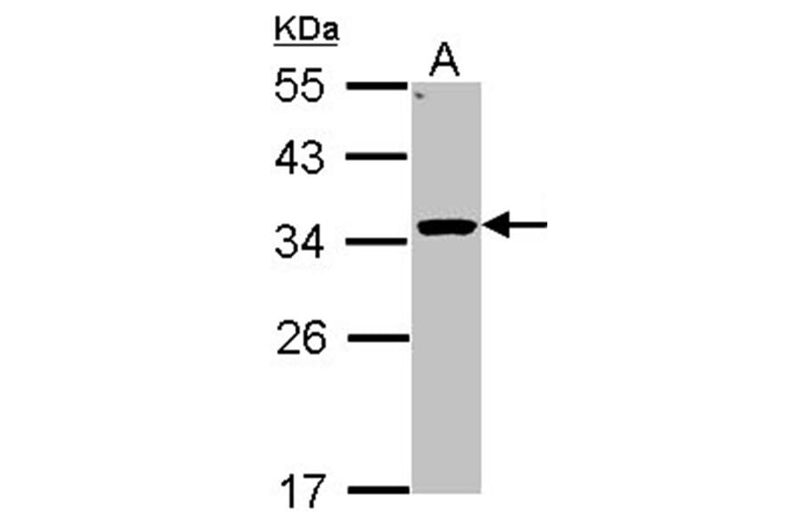 HSD11B1 antibody from Signalway Antibody (22621) - Antibodies.com