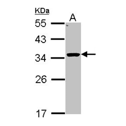 HSD11B1 antibody from Signalway Antibody (22621) - Antibodies.com