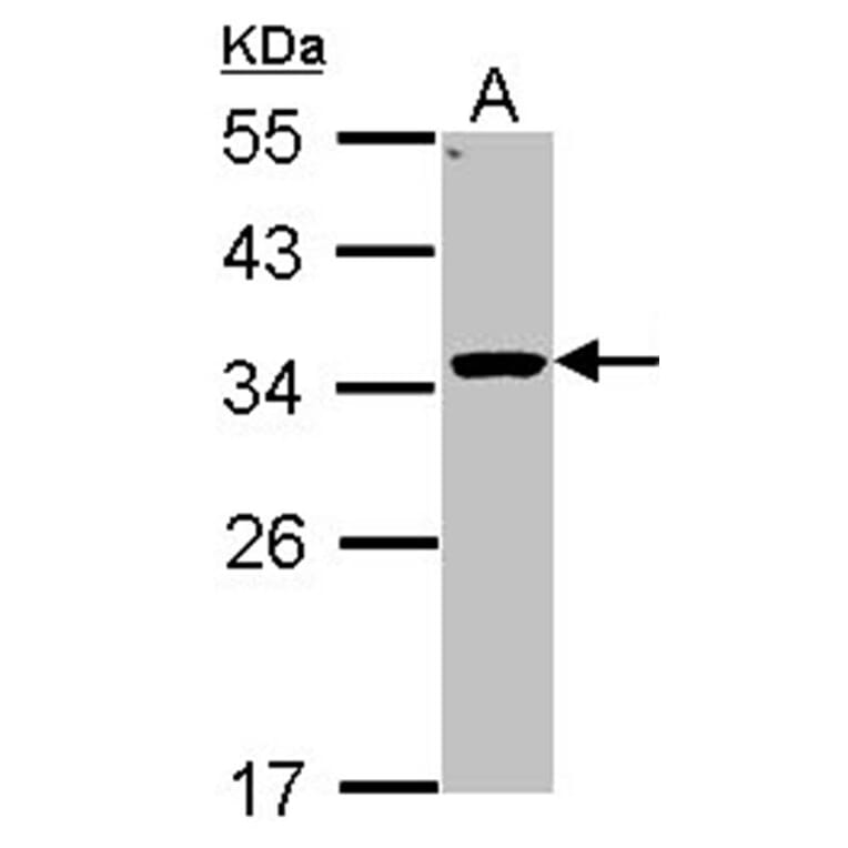 HSD11B1 antibody from Signalway Antibody (22621) - Antibodies.com