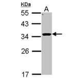 HSD11B1 antibody from Signalway Antibody (22621) - Antibodies.com