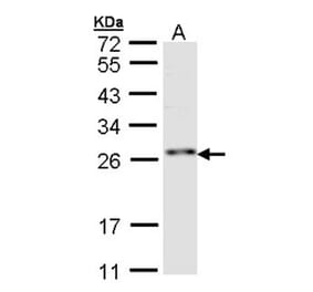 ZNF313 antibody from Signalway Antibody (22753) - Antibodies.com