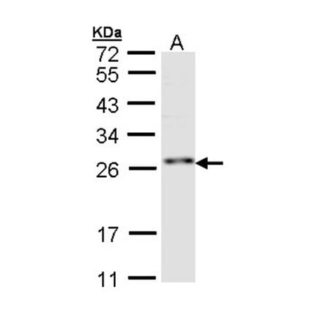 ZNF313 antibody from Signalway Antibody (22753) - Antibodies.com