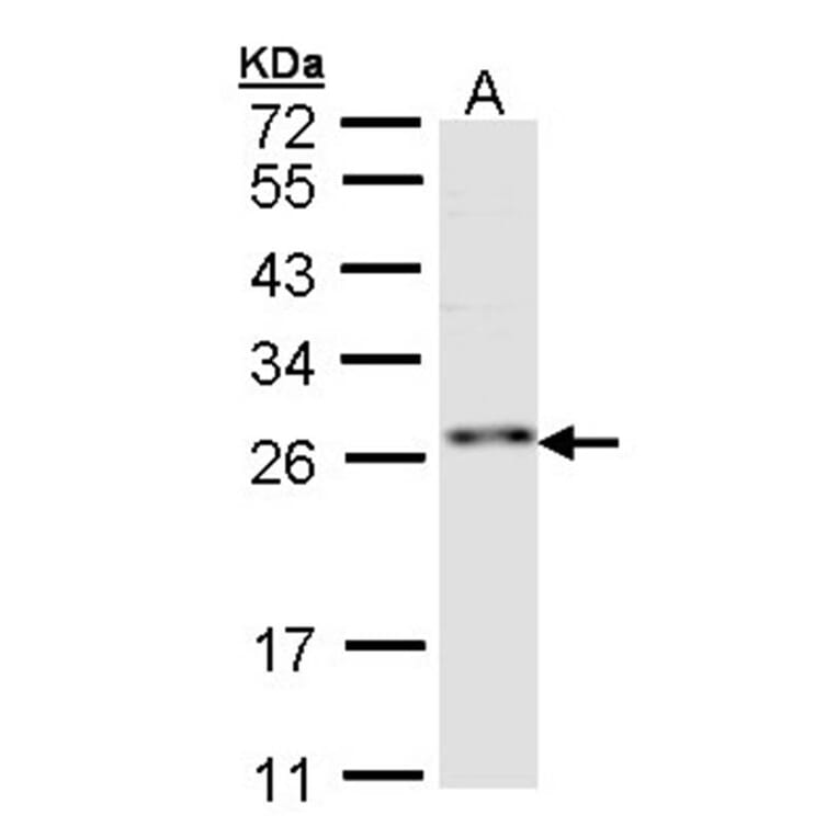 ZNF313 antibody from Signalway Antibody (22753) - Antibodies.com