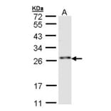 ZNF313 antibody from Signalway Antibody (22753) - Antibodies.com