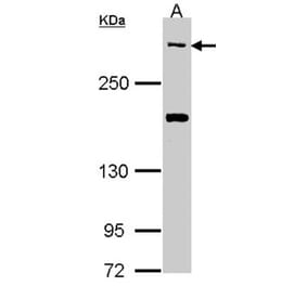 CACNA1B antibody from Signalway Antibody (22790) - Antibodies.com