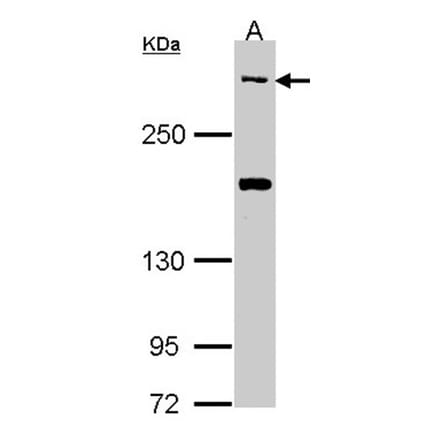 CACNA1B antibody from Signalway Antibody (22790) - Antibodies.com