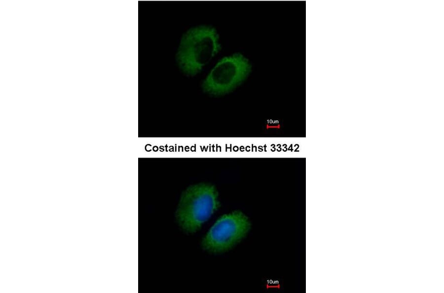 Immunofluorescence - CACNA1B antibody from Signalway Antibody (22790) - Antibodies.com
