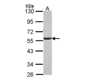 Dkk-3 antibody from Signalway Antibody (22898) - Antibodies.com