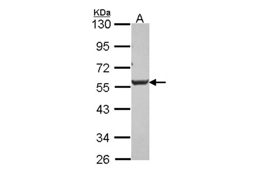 Dkk-3 antibody from Signalway Antibody (22898) - Antibodies.com