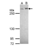 LTBP-4 antibody from Signalway Antibody (23084) - Antibodies.com