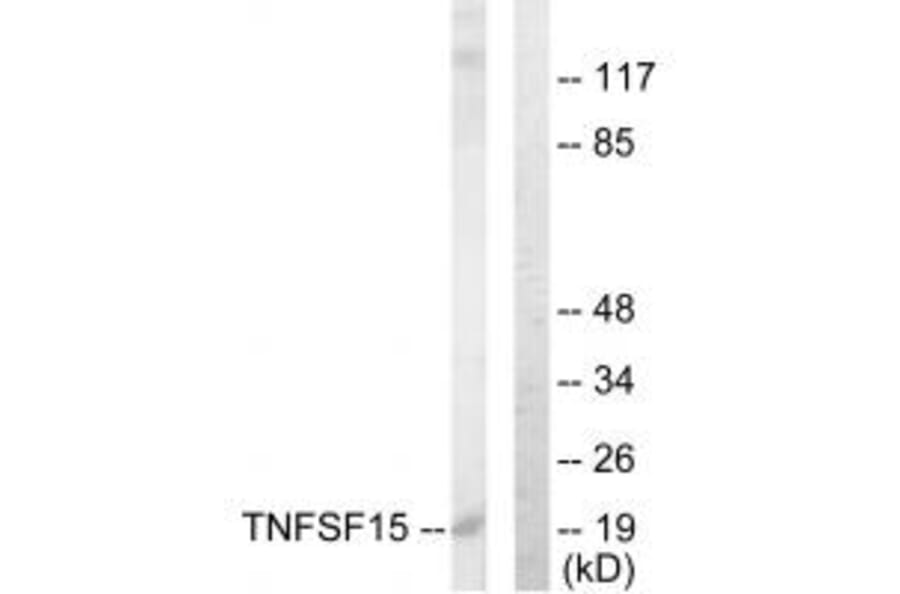 Western blot - TNFSF15 Antibody from Signalway Antibody (33626) - Antibodies.com