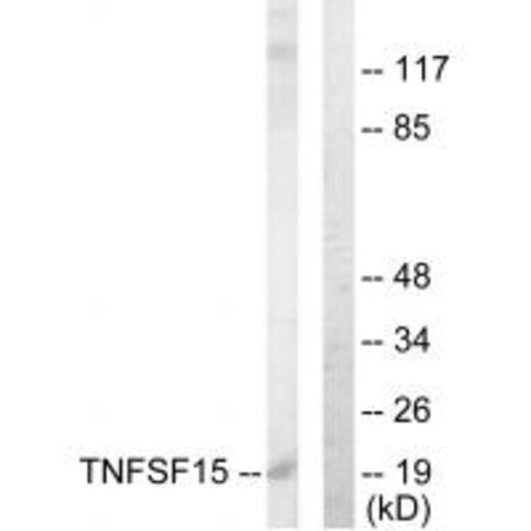 Western blot - TNFSF15 Antibody from Signalway Antibody (33626) - Antibodies.com