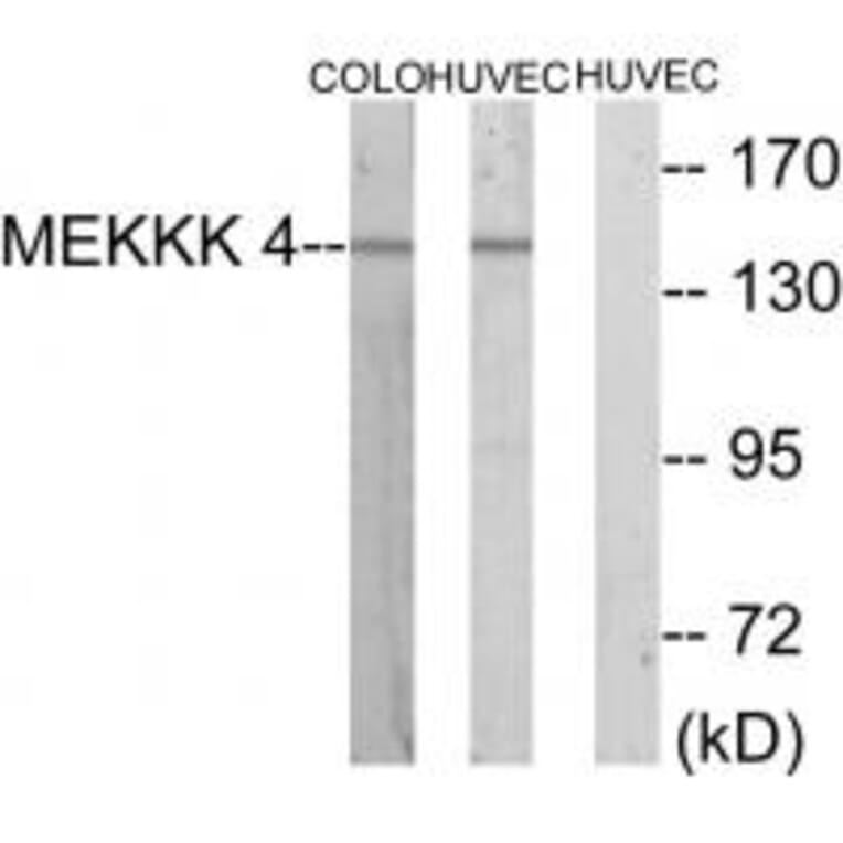 Western blot - MEKKK 4 Antibody from Signalway Antibody (33638) - Antibodies.com