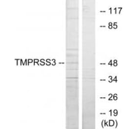 Western blot - TMPRSS3 Antibody from Signalway Antibody (33829) - Antibodies.com