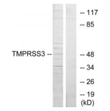 Western blot - TMPRSS3 Antibody from Signalway Antibody (33829) - Antibodies.com