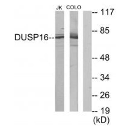 Western blot - DUSP16 Antibody from Signalway Antibody (34049) - Antibodies.com