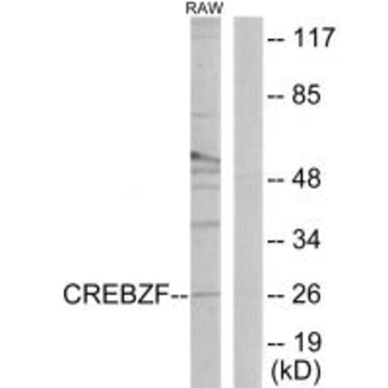 Western blot - CREBZF Antibody from Signalway Antibody (34077) - Antibodies.com