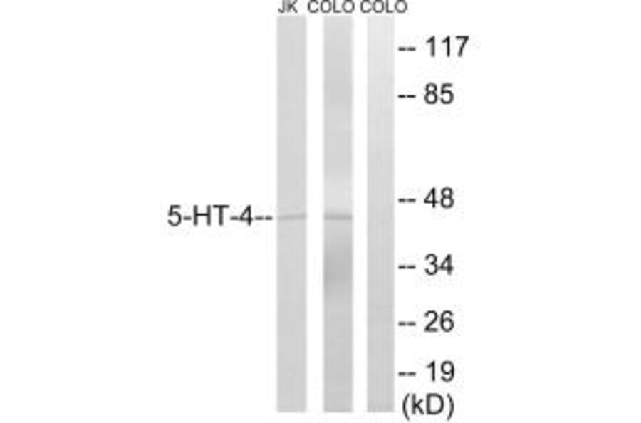 Western blot - 5-HT-4 Antibody from Signalway Antibody (34153) - Antibodies.com