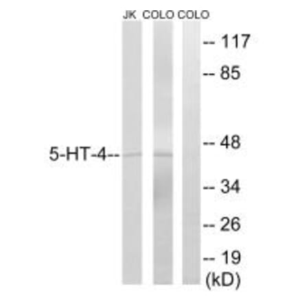 Western blot - 5-HT-4 Antibody from Signalway Antibody (34153) - Antibodies.com