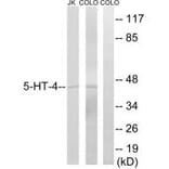 Western blot - 5-HT-4 Antibody from Signalway Antibody (34153) - Antibodies.com