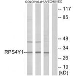 Western blot - RPS4Y1 Antibody from Signalway Antibody (34340) - Antibodies.com