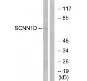 Western blot - SCNN1D Antibody from Signalway Antibody (34408) - Antibodies.com