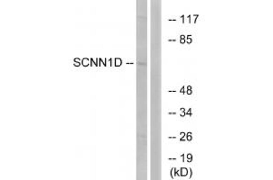 Western blot - SCNN1D Antibody from Signalway Antibody (34408) - Antibodies.com