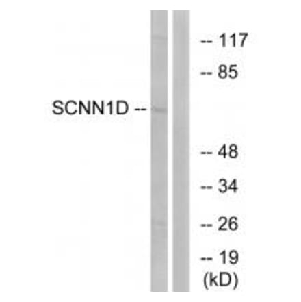 Western blot - SCNN1D Antibody from Signalway Antibody (34408) - Antibodies.com