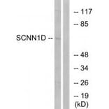 Western blot - SCNN1D Antibody from Signalway Antibody (34408) - Antibodies.com