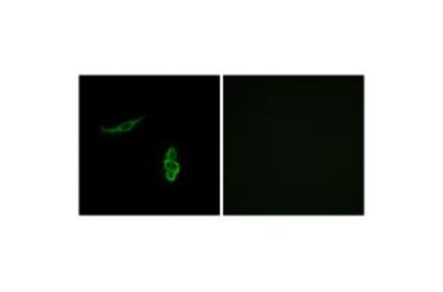 Immunofluorescence - SCNN1D Antibody from Signalway Antibody (34408) - Antibodies.com