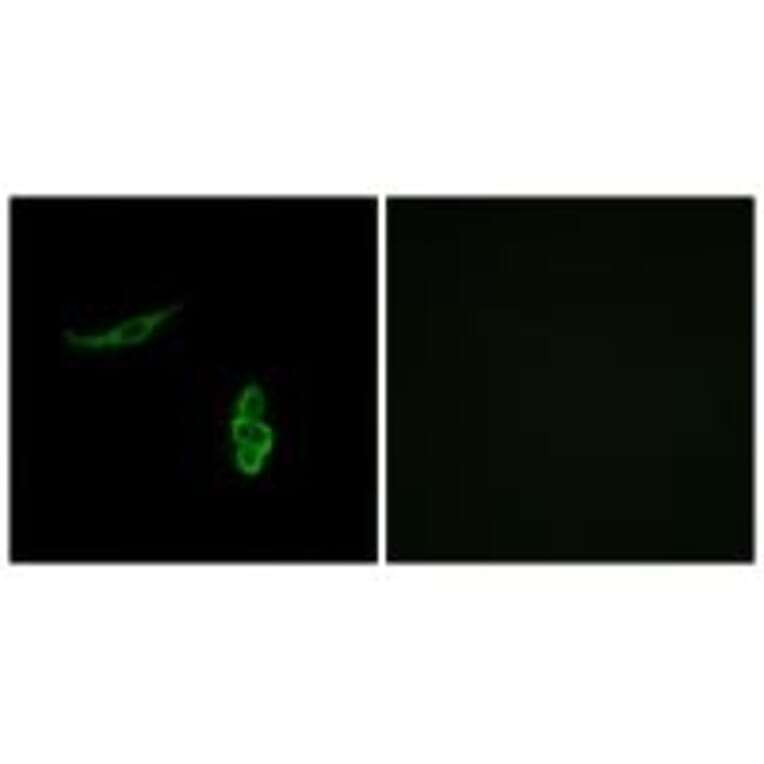 Immunofluorescence - SCNN1D Antibody from Signalway Antibody (34408) - Antibodies.com