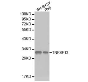 Western blot - TNFSF13 antibody from Signalway Antibody (38224) - Antibodies.com