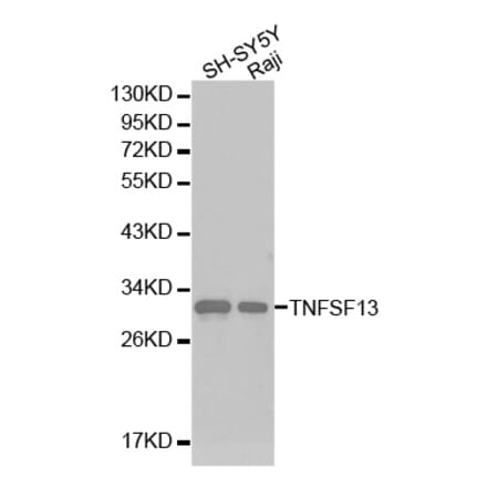 Western blot - TNFSF13 antibody from Signalway Antibody (38224) - Antibodies.com