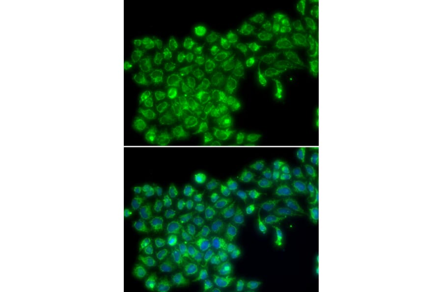 Immunofluorescence - TNFSF13 antibody from Signalway Antibody (38224) - Antibodies.com