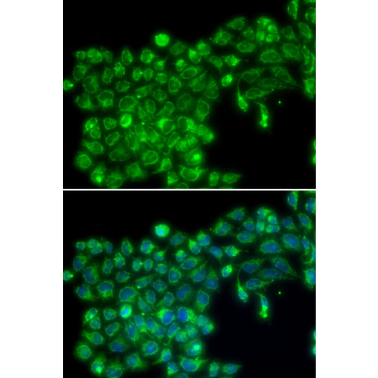 Immunofluorescence - TNFSF13 antibody from Signalway Antibody (38224) - Antibodies.com