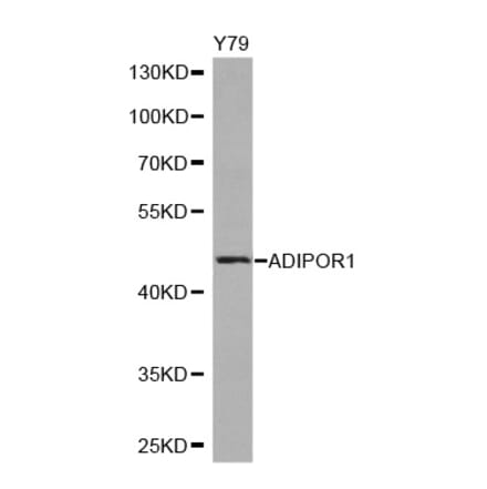 Western blot - ADIPOR1 antibody from Signalway Antibody (38245) - Antibodies.com