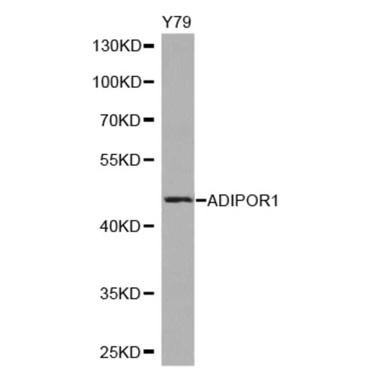 Western blot - ADIPOR1 antibody from Signalway Antibody (38245) - Antibodies.com