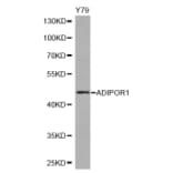 Western blot - ADIPOR1 antibody from Signalway Antibody (38245) - Antibodies.com