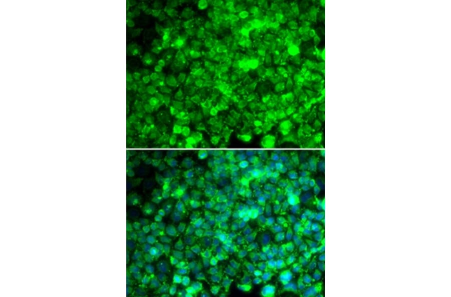 Immunofluorescence - ADIPOR1 antibody from Signalway Antibody (38245) - Antibodies.com