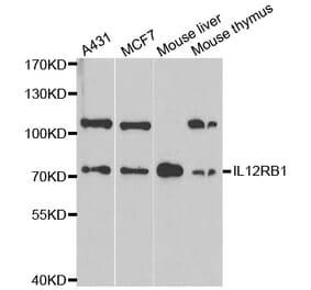 Western blot - IL12RB1 antibody from Signalway Antibody (38313) - Antibodies.com