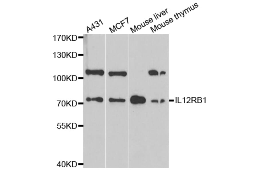 Western blot - IL12RB1 antibody from Signalway Antibody (38313) - Antibodies.com