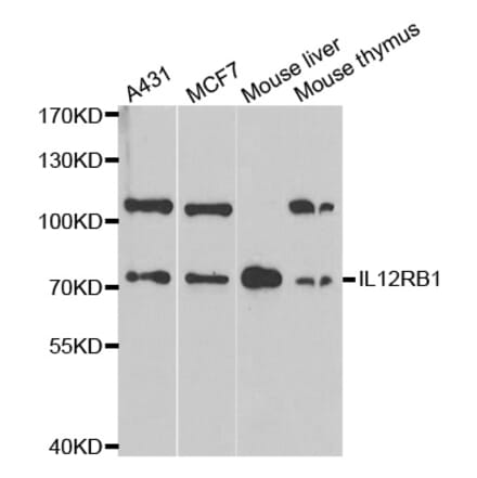 Western blot - IL12RB1 antibody from Signalway Antibody (38313) - Antibodies.com