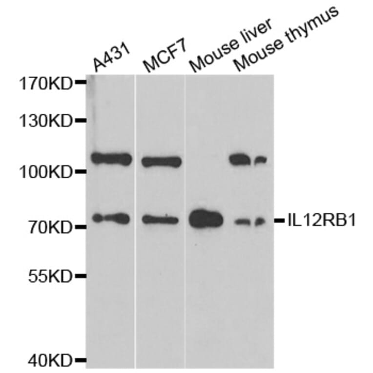 Western blot - IL12RB1 antibody from Signalway Antibody (38313) - Antibodies.com
