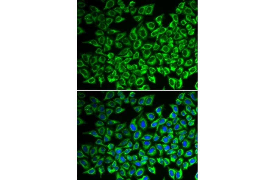 Immunofluorescence - IL12RB1 antibody from Signalway Antibody (38313) - Antibodies.com