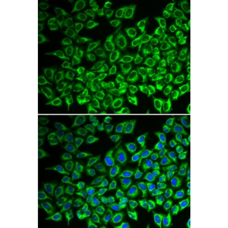 Immunofluorescence - IL12RB1 antibody from Signalway Antibody (38313) - Antibodies.com