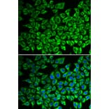 Immunofluorescence - IL12RB1 antibody from Signalway Antibody (38313) - Antibodies.com